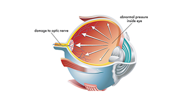 Bellefonte Eye Doctor